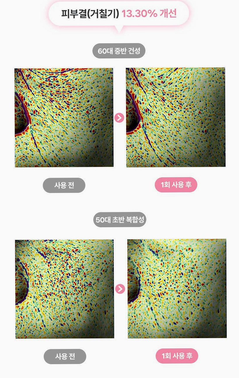 펄리 엑소좀 피부과재생크림 수분 보습 시카 히알루론산 물광크림 40ml, 1개
